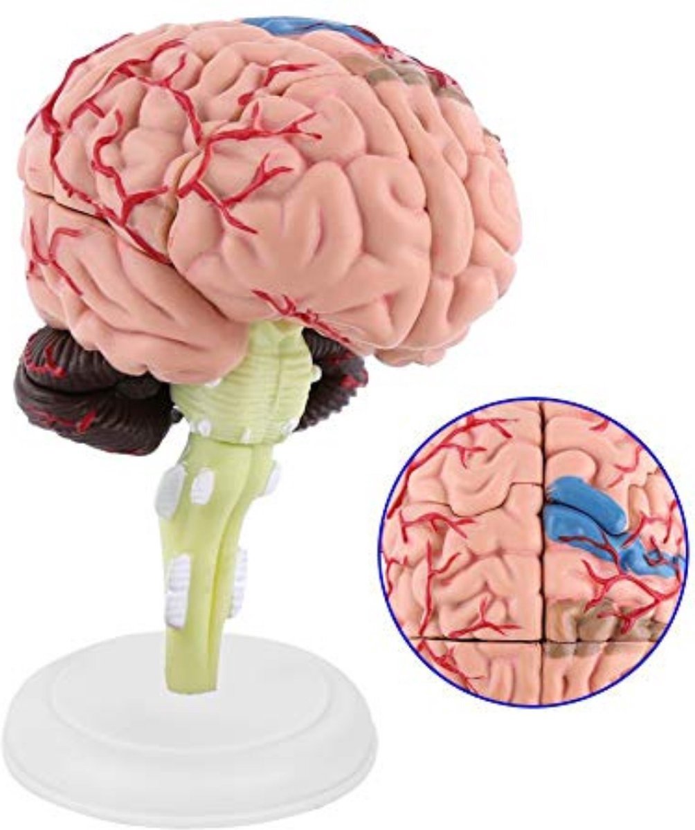 WNHB® Menselijk breinmodel anatomisch 8-delig - educatief leerhulpmiddel - 3D hersenmodel voor studie en training